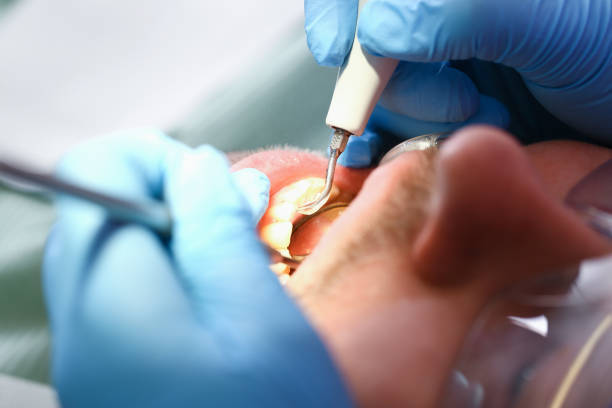 Best Emergency Broken Tooth Repair in Melvindale, MI