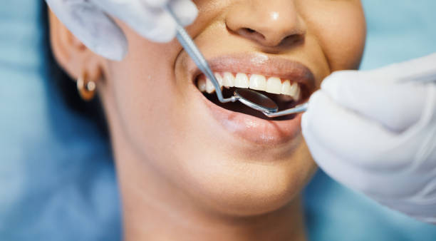 Best Emergency Wisdom Teeth Removal in Melvindale, MI